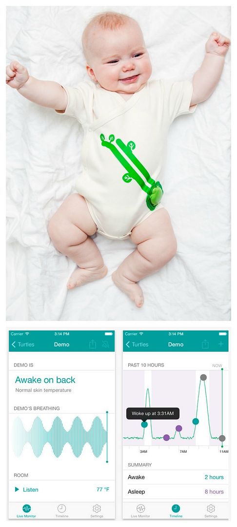 Mimo Wearable Baby Tracker | One of 3 new werable baby monitors worth looking at